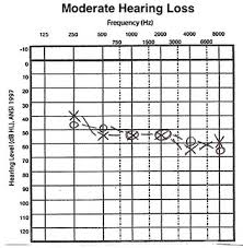 Hearing Evaluation Image